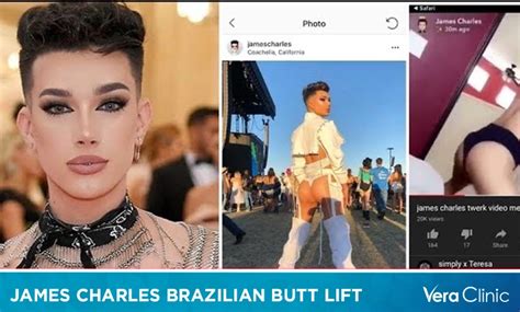 james charles butt|James Charles Seemingly Admits to Getting a BBL on。